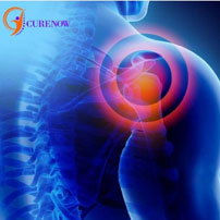  Instant Steam Treatment for Frozen Shoulder.